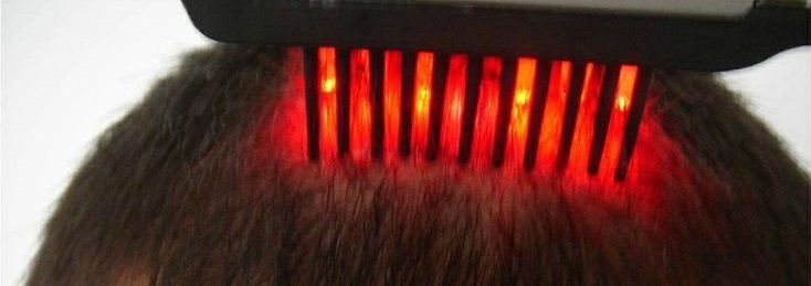 Hair Growth with Laser Comb